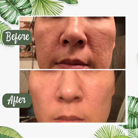 🔥Hot Sale-49% OFF🔥  Green Tea Deep Cleanse Mask Stick