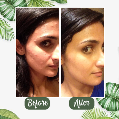 🔥Hot Sale-49% OFF🔥  Green Tea Deep Cleanse Mask Stick