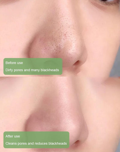 🔥Hot Sale-49% OFF🔥  Green Tea Deep Cleanse Mask Stick